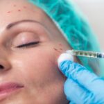 Anti-aging PRP Aesthetic Medicine Treatment