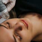 Microneedle RF lifting procedure. Hardware cosmetology.