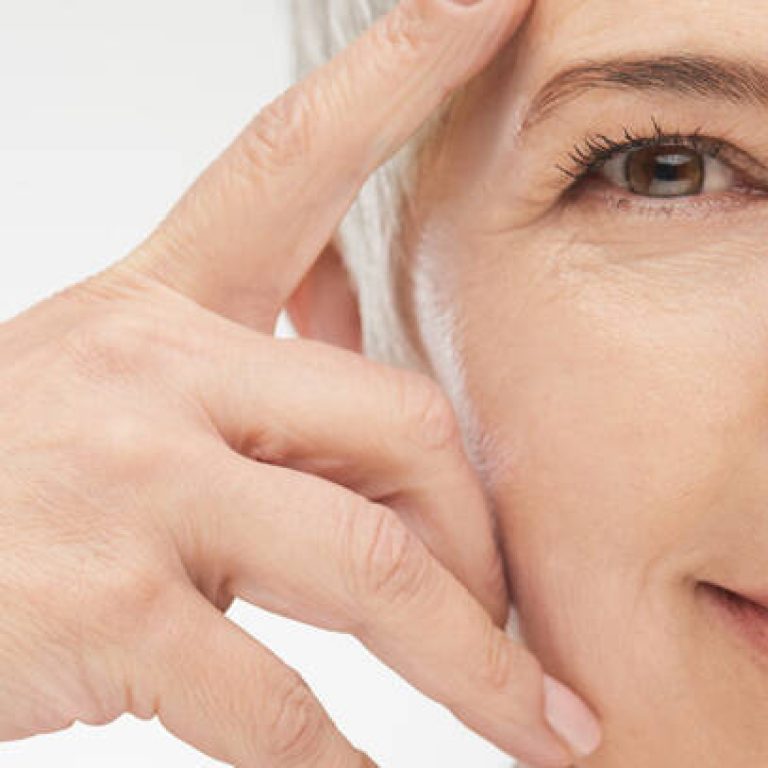 Fotona SmoothEye non surgical eye lift